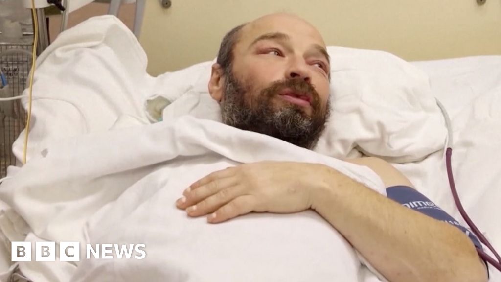 Man rescued after 67 days adrift speaks of his survival